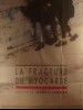LA FRACTURE DU MYOCARDE